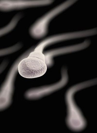 Alergija na spermu