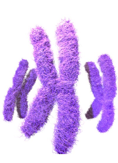 Klinefelterov sindrom - trizomija polnog hromozoma