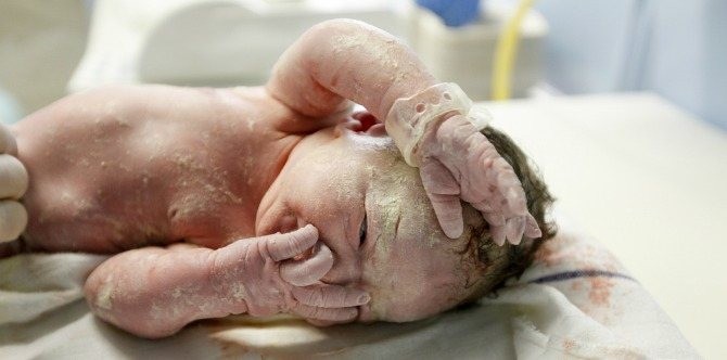 Beli kaputić sa kojim se beba rađa: Sirasti maz