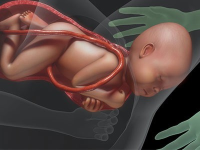Kada je bebina glava izašla, potrebna je još jedna kontrakcija da izađe i ostatak tela