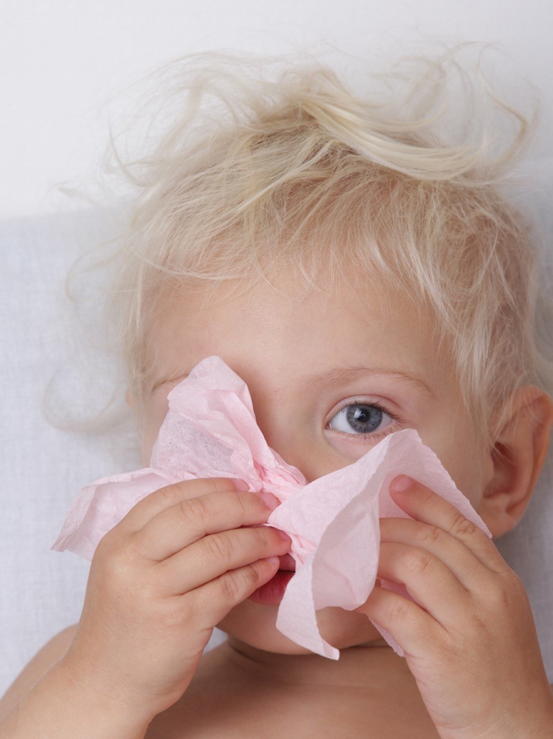 Alergija kod dece
