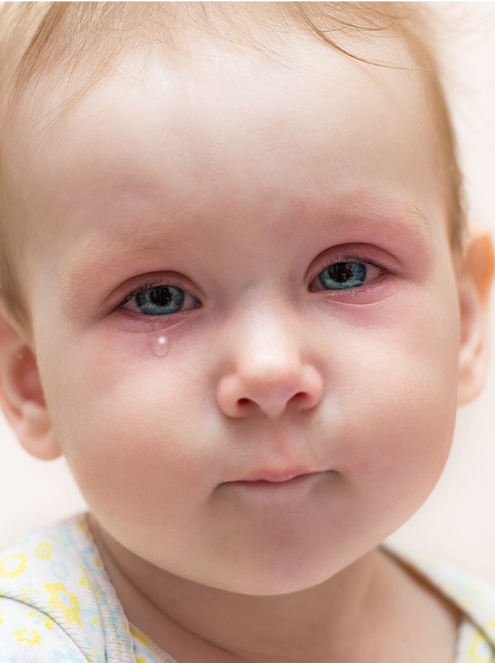 Konjuktivitis kod dece i beba