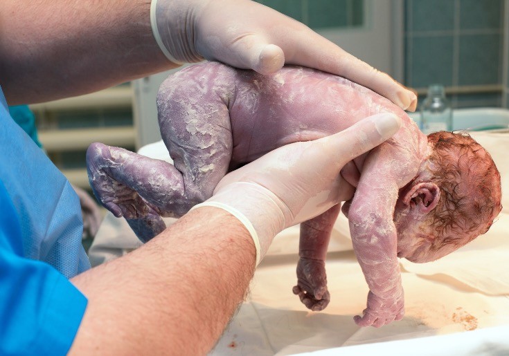 Neonatolog proverava bebine reflekse odmah po rođenju.