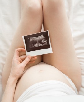 Ekspertski ultrazvuk između 20. i 24. nedelje trudnoće - zašto je bitan i šta se sve može videti?
