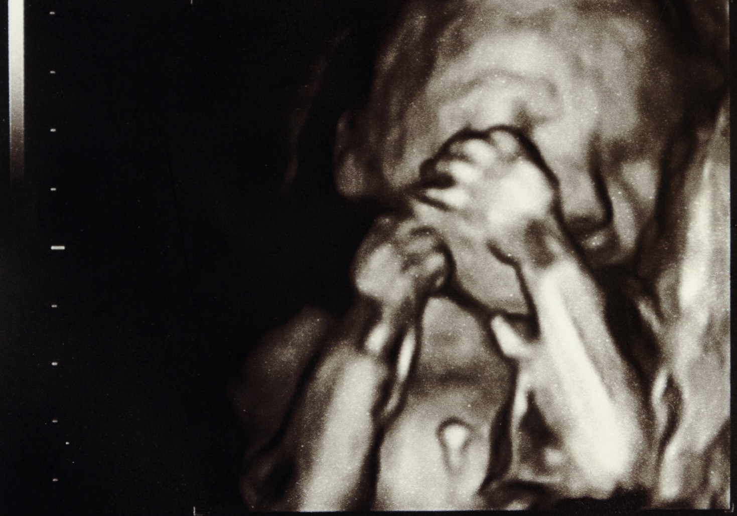 Ultrazvučni prikaz bebe u 6. mesecu trudnoće